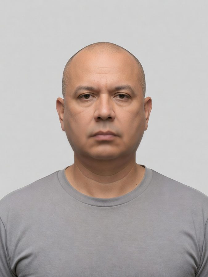 Midface volume restored with two syringes — after