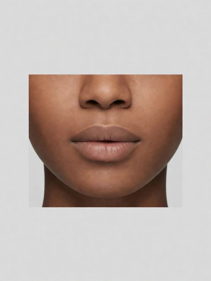 Lip balance rather than lip volume — after
