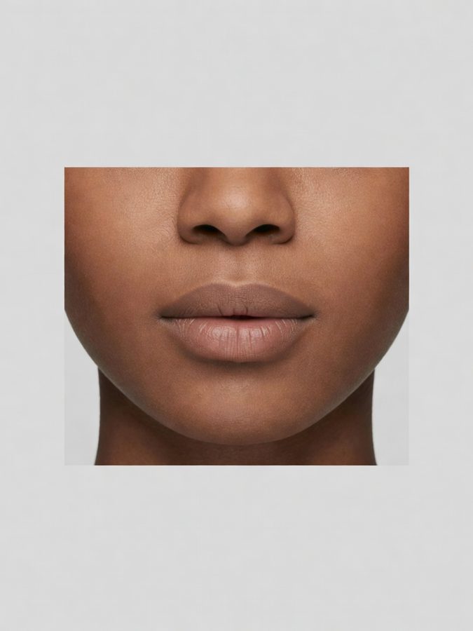 Lip balance rather than lip volume — before